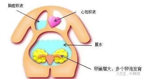 如何降低卵巢过度刺激综合的发生？(图2)