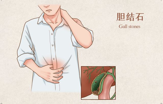 竞博JBO《漫长的季节》彪子瘦了20斤！明星同款减肥食谱咱普通人也能跟着用吗？(图4)